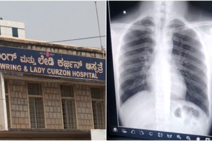Patients face inconvenience as Bowring hospital runs out of X-ray photo films