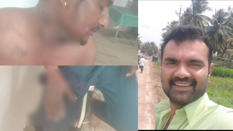 Man sets youth on fire for not giving chit fund money
